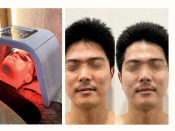 コアラル 麻布十番(COALALU)/お悩み別に合わせる多種ライト☆