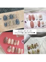 ビネイル(BINAIL)/