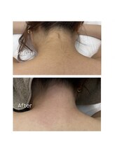 39 beauty salon.横浜関内【WAX脱毛/メンズ眉毛/水素吸入しながら】/うなじWax