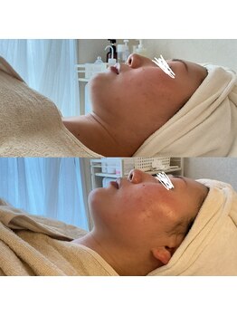 サロン ド ビビ(salon de bibi*)/全体引き上げ+ボリュームダウン