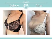 美人バスト 浦和店/【バストアップ★育乳】症例