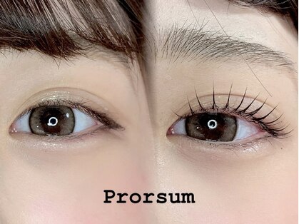 プローサム(Prorsum)の写真