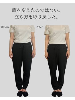 リ バース 立川(RE:birth)/美脚　BeforeAfter