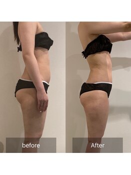 エイジングケアサロン 青山 本店/3種マシン・90分最強痩身!