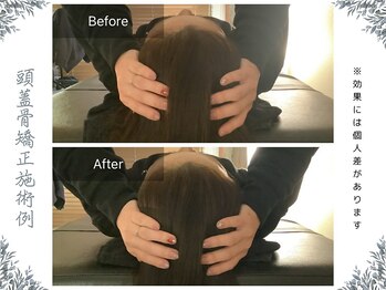 ボディ リセット アンド デザイン(Body Reset & Design)/【施術例】ビフォーアフター