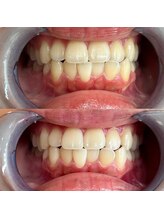 ライトビューティー 池袋店(LightBeauty)/症例写真