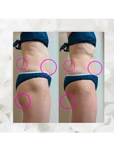 ヨサパーク エトワール 聖蹟桜ヶ丘店(YOSAPARK)/before、after♪