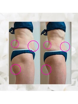 ヨサパーク エトワール 聖蹟桜ヶ丘店(YOSAPARK)/before、after♪