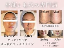 ナチュラ 諫早店(NAchuRA)