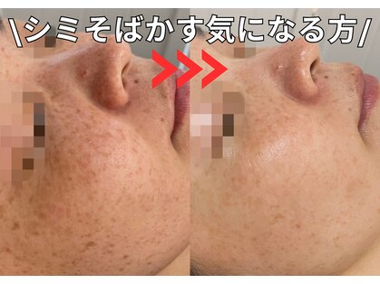 ベルファーム(Belle Femme)の写真