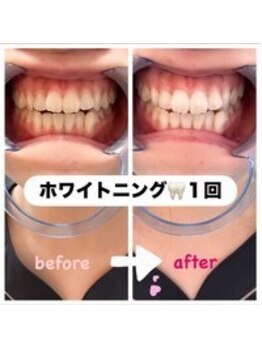 レア(le`a)/～セルフホワイトニング効果～