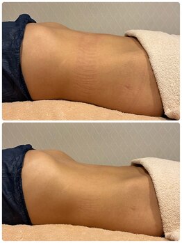 ビューティーサロン ラグジューム(Beauty salon Laxum)/赤岩式腸けずり