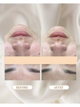 トロワ(TROIS)/きれいをアップデート