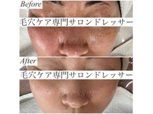 ドレッサー(Dresser)の雰囲気(何処に行っても納得出来なかったお客様が初めて変われたと実感)