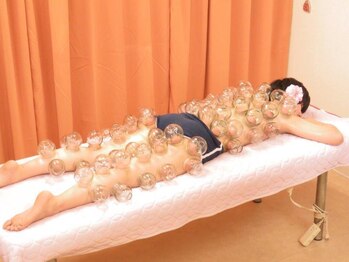 足浴堂/カッピングで血流改善