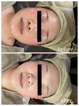 ジャスミン(Jasmin)/オーダーメイド高濃度原液導入