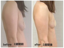 イベリス(IBERIS.)/当店ビフォーアフター