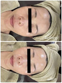 ジャスミン(Jasmin)/エステティック×シェービング