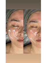 ナーズ(NAZ)/リフトアップ