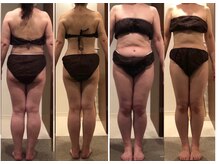 トレーニング アンド サロン ツグミ(Tsugumi)の雰囲気（インディバで筋肉を緩ませながら同時進行でハンドマッサージ♪）
