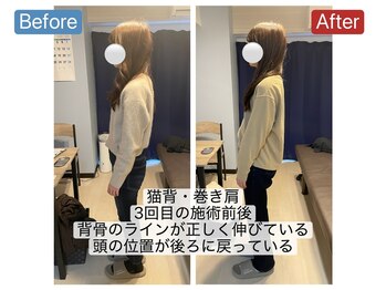 アンティオール 桜木町店/Before→After