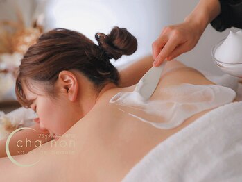 シェノン(chainon)の写真/大切な日まで期間が少ない方にも◎背中トラブルや産毛ケアも諦めないで！