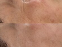 ヴェルシック(Belchic)の雰囲気（【細胞から若々しくなる復元フェイシャル】シワも少しずつ改善）