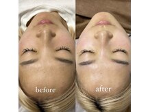 ティアラ 葛西店(TIARA)の雰囲気（TIARAのSpecial技術でお肌も心も全てアップデート☆）