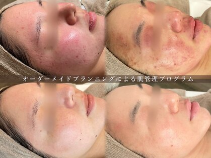 シーヴォーク(Cveauque)の写真