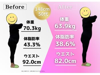 鍼灸整骨院ゼット(Z)/ダイエット成功!