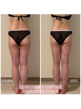 ヒーリングサプリ(Healing Supple)/細胞活性化はダイエットの基本