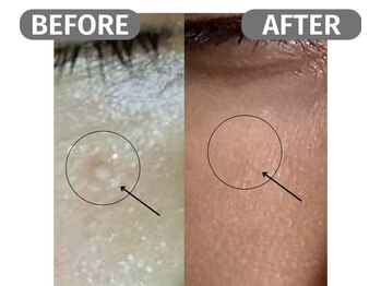 インフィニート 上野毛(infinito)/★BEFORE/AFTER★