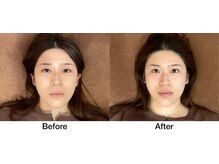 こじま 富雄団地接骨院/Before&After