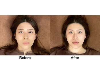 こじま 富雄団地接骨院/Before&After