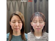 鍼灸チャンドラ(鍼灸Chandra)の雰囲気（結果重視の美容鍼）