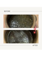 カロレ(Calore)/ツボ《before→after》