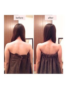 シナジェ 岡山店(Synergye)/気になる背中のケアにも◎