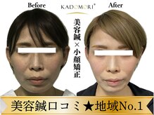 カドモリ 心斎橋(KADOMORI)