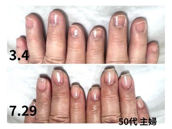 カンナ(Kanna)/「小さい爪が縦長に｜自爪育成」