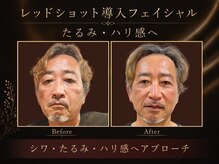 ビーシャルム(b.ChaRme)の雰囲気（韓国発★自分史上最高の若見え体感を★シワたるみ・ハリ・水光肌）