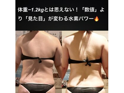 ヨサパーク ボヌール 門司駅店(YOSA PARK bonheur)の写真