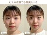【むくみ・エラ張り】小顔矯正+美容整体★リフトアップ小顔へ 12000円→