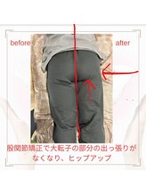和ぎ整体院/股関節矯正で改善