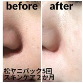 すっぴん美肌を叶える魔法のサロン