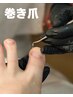 【巻き爪でお悩みの方必見!】通常1指¥6,000→初回限定!今だけ1指¥4,000