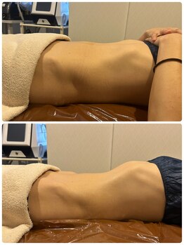 ビューティーサロン ラグジューム(Beauty salon Laxum)/赤岩式腸けずり