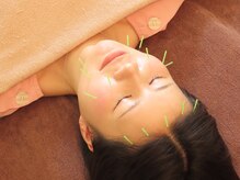 《お顔やお身体ののお悩みお任せ下さい》「優しい鍼」をご体験♪