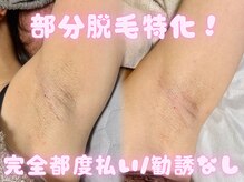 リモア(Remore)の雰囲気（気になる箇所だけ通える部分脱毛が人気！）