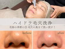 ルアイナ 吉祥寺(Ruaina)の雰囲気( 美容液の水流で毛穴すっきり、透明感のあるつるすべ肌へ)