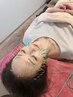  【全員/美容鍼】 小顔100本美容鍼（電気鍼+頭首肩マッサージ+首矯正）